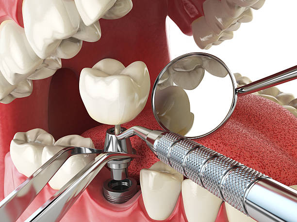 Best Emergency Gum Treatment in Oak Grove, MN